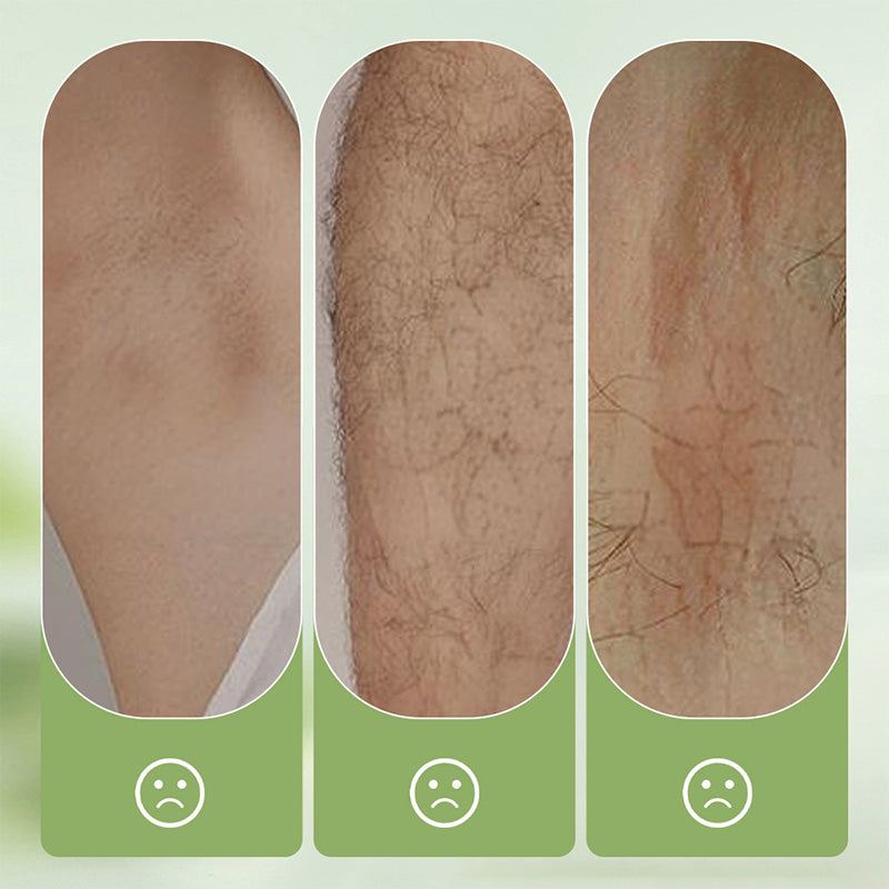 🏖️50% OFF⚡50K+ SOLD💕🎁Gentle and Non-Irritating Hair Removal Cream