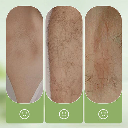 🏖️50% OFF⚡50K+ SOLD💕🎁Gentle and Non-Irritating Hair Removal Cream