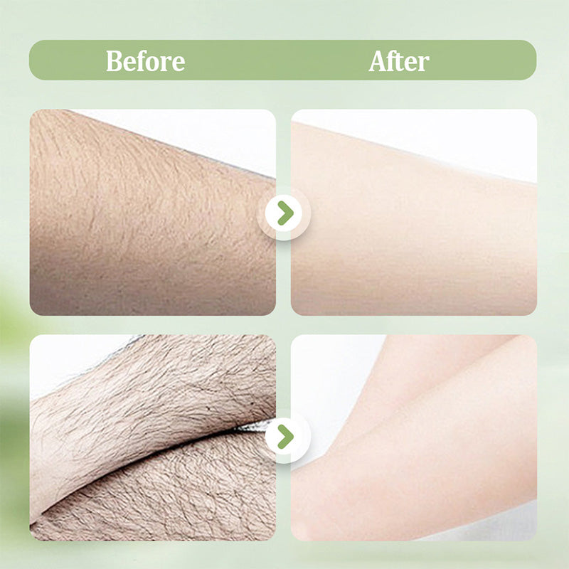 🏖️50% OFF⚡50K+ SOLD💕🎁Gentle and Non-Irritating Hair Removal Cream